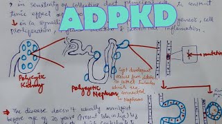 Autosomal Dominant Polycystic Kidney Disease [upl. by Elleahcim209]