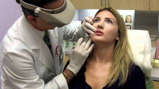 Juvederm Lip Filler  Total Dermatology [upl. by Aikenahs]