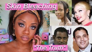 Why would anyone do this Skin Bleaching amp Beauty Standards The TRUTH [upl. by Norrabal]