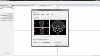 Step 1 Open raw dicom files [upl. by Carlile]