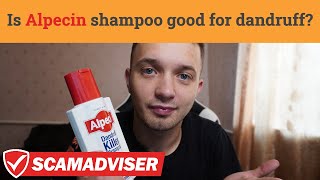 Alpecin Dandruff Killer Shampoo review after 3 months Is it the best anti dandruff product [upl. by Ojok]