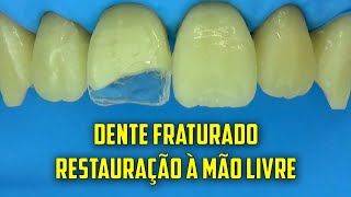 Restauração de dente fraturado em sessão única  Técnica a mão livre [upl. by Aivull]