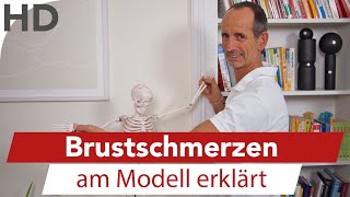 Ursachen von Schmerzen am Brustmuskel  Das kann es sein [upl. by Marylou]