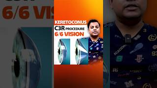 Treatment for Keratoconus  C3R [upl. by Ateuqram]