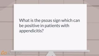 What is the psoas sign [upl. by Nyrac196]