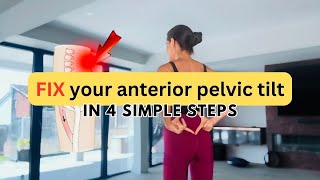 Fix your anterior pelvic tilt in 4 simple steps [upl. by Dene]