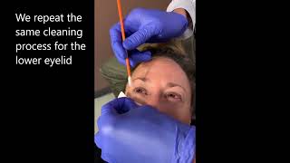 Zest  Demodex Blepharitis Eyelashes Cleaning [upl. by Okier]