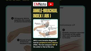 Ankle Brachial Index ABI doctor nursing medical [upl. by Esialb368]