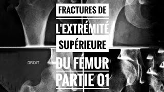 Fractures de L’extrémité Supérieur du Fémur  partie 01 Anatomopathologie Classifications [upl. by Ssirk]