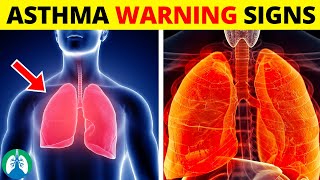 Top Early Warning Signs of Asthma That You Should NEVER IGNORE [upl. by Adamo660]