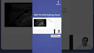 NEET PG 2024 Radiology Recall by Dr Zainab Vora  Cerebellum Academy [upl. by Mortimer]