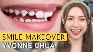 INCREDIBLE Smile Makeover  Dr Kayla Dental Clinic YvonneChua [upl. by Dorwin]