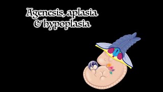 Agenesis Aplasia and Hypoplasia [upl. by Izabel]