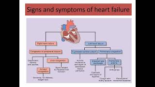 treatment of Congestive heart failure part 1 2024 [upl. by Sanbo517]