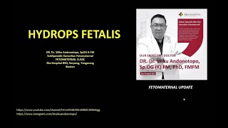 Hydrops Fetalis Dr Wiku Andonotopo [upl. by Selene427]