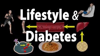 How Unhealthy Lifestyle Can Cause Prediabetes and Diabetes Animation [upl. by Worlock101]