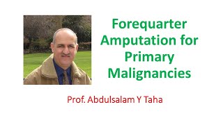 Forequarter Amputation for Primary Malignancies [upl. by Bundy]