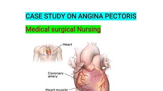 CASE STUDY ON ANGINA PECTORIS NURSING CASE STUDY ON ANGINA PECTORIS [upl. by Isbella680]