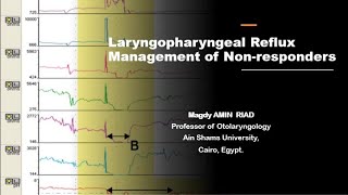 Laryngopharyngeal Reflux Management of Non responders [upl. by Esinahs]