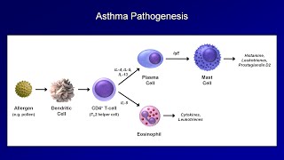 Asthma and COPD  Pathogenesis and Pathophysiology [upl. by Ah]