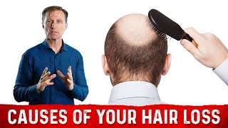 The Underlying Root Cause Of Hair Loss – Treatment For Hair Loss Dr Berg [upl. by Hovey]