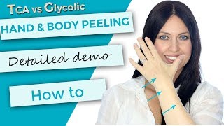 How to Glycolic Peel at HOME [upl. by Ssecnirp]