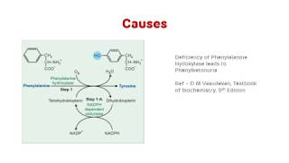 Phenylketonuria PKU  Phenylalanine Metabolism [upl. by Letnom]