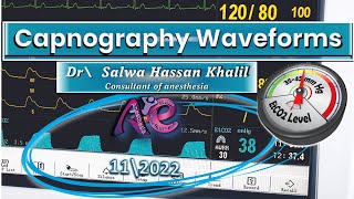 Capnograph Waveform amp Their interpretations amp How to read EtCO2 waveform With video illustrations [upl. by Oneladgam]