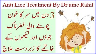 Anti lice Treatment By Dr Umme Raheel  To Get ride off from Head lice just in 3 Days  100 works [upl. by Mireille]