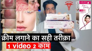 क्रीम लगाने का सही तरीक़ा  elosone ht cream  elosone ht cream review elosone ht cream sids effect [upl. by Terrell]