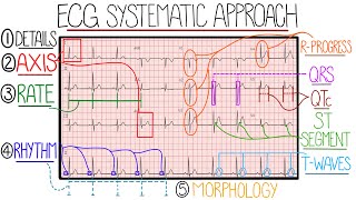 ECG Interpretation Made Easy Learn How to Interpret an ECG in 13 Minutes [upl. by Verbenia59]