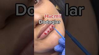 microblading keşfetteyiz bakuazerbaijan baku lips [upl. by Laforge796]