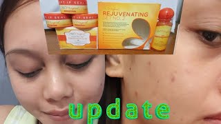 SKIN MAGICAL REJUVENATING SET 2 UPDATEEXPERIENCETIPS [upl. by Benildas869]