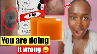 ✨HOW TO PROPERLY USE KOJIC ACID SOAP TO GET RID OF HYPERPIGMENTATION amp Dark spot [upl. by Ileray]