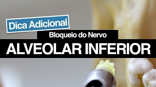 Bloqueio do Nervo Alveolar Inferior  Dicas Adicionais Para Aumentar o seu Sucesso [upl. by Aciamaj]