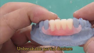 flexible removable partial denture dentistry dentaldentist flexible dentures [upl. by Jacquet]