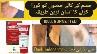 Whitening of Dark underarms  Eventone C cream uses [upl. by Natalina576]