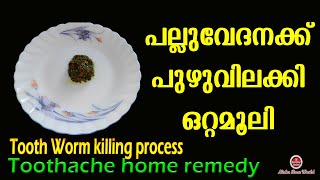 പുഴുവിലക്കി ഒറ്റമൂലി പച്ചമരുന്ന്  Pallu vedana maran  Toothache home remedy [upl. by Rimas200]