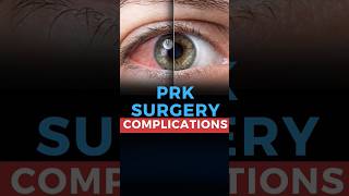 Photorefractive Keratectomy PRK Surgery Complications [upl. by Sardella255]