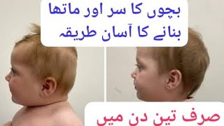 Bachon Ka Matha Or sir banany Ka Asaan Tarika  How to shape babys head and forehead [upl. by Ynneb807]