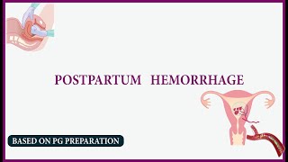 postpartum haemorrhage  NEET PG [upl. by Rafael]