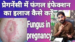 प्रेगनेंसी में फंगल इन्फेक्शन का इलाज कैसे करें।How to treat fungus in pregnancy by ammar rashid kha [upl. by Ashmead313]