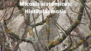 10 Micosis sistémicas Histoplasmosis [upl. by Dehnel194]