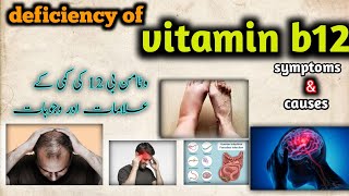 vitamin b12 deficiencysymptomscausesvitamin b12 ki kami se kya hota haimedical knowledge pk [upl. by Haneekas]