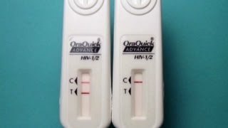 FDA has approved Home HIV Test Kit [upl. by Aznola]