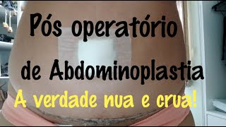 Pós operatório de Abdominoplastia lipoaspiração e enxerto de glúteo  dicas [upl. by Inama]