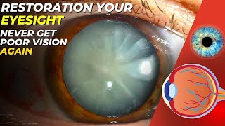 Restoration your Eyesight within 30 Days  Restore Vision Naturally [upl. by Stoller363]