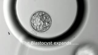 Blastocyst Development  Day 3 to Day 5 MUST SEE [upl. by Hazlip]