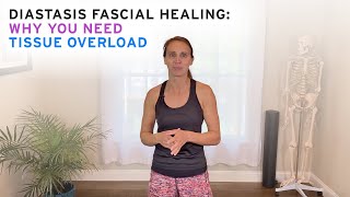 Diastasis Fascial Healing  Why you need Tissue Overload [upl. by Omidyar]