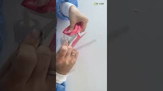 Dental Base Plate Wax [upl. by Adiazteb]